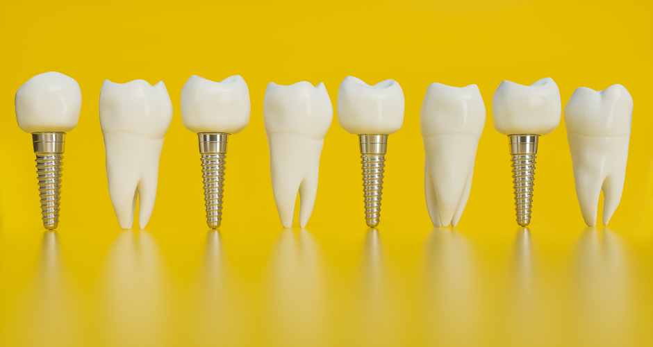 Implantologie Bad Homburg - Zahnarzt Dr. med. dent. J.Kim